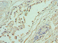 Immunohistochemistry of paraffin-embedded human prostate tissue using CSB-PA001348ESR1HU at dilution of 1:100