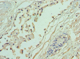 Immunohistochemistry of paraffin-embedded human prostate tissue using CSB-PA001348ESR1HU at dilution of 1:100