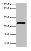 ADH1B Antibody, HRP conjugated – Figure 1 of 4
