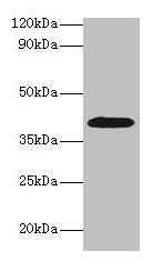 ADH1B Antibody, FITC conjugated – Figure 1 of 4