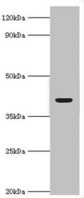 Western blot
All lanes: Alcohol dehydrogenase 4 antibody at 2ug/ml + Mouse liver tissue
Secondary
Goat polyclonal to rabbit IgG at 1/10000 dilution
Predicted band size: 41, 43 kDa
Observed band size: 41 kDa
