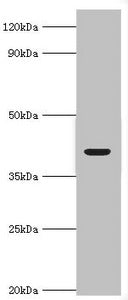 Western blot
All lanes: Alcohol dehydrogenase 4 antibody at 2ug/ml + Mouse liver tissue
Secondary
Goat polyclonal to rabbit IgG at 1/10000 dilution
Predicted band size: 41, 43 kDa
Observed band size: 41 kDa