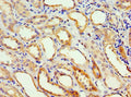 Immunohistochemistry of paraffin-embedded human kidney tissue using CSB-PA001356ESR2HU at dilution of 1:100