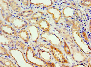 Immunohistochemistry of paraffin-embedded human kidney tissue using CSB-PA001356ESR2HU at dilution of 1:100
