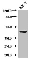 Western Blot
Positive WB detected in: MCF-7 whole cell lysate
All lanes: ADIPOR1 antibody at 2.5µg/ml
Secondary
Goat polyclonal to rabbit IgG at 1/50000 dilution
Predicted band size: 43 kDa
Observed band size: 43 kDa