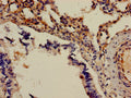 Immunohistochemistry of paraffin-embedded human lung tissue using CSB-PA001370HA01HU at dilution of 1:100