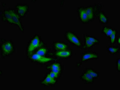 Immunofluorescent analysis of Hela cells using CSB-PA001375EA01HU at dilution of 1:100 and Alexa Fluor 488-congugated AffiniPure Goat Anti-Rabbit IgG(H+L)