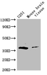 Western Blot
Positive WB detected in: Mouse brain tissue
All lanes: ADORA2B antibody at 3ug/ml
Secondary
Goat polyclonal to rabbit IgG at 1/50000 dilution
Predicted band size: 37 kDa
Observed band size: 37 kDa