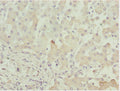Immunohistochemistry of paraffin-embedded human liver tissue using CSB-PA001380ESR1HU at dilution of 1:100