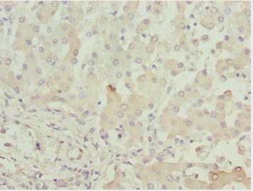 Immunohistochemistry of paraffin-embedded human liver tissue using CSB-PA001380ESR1HU at dilution of 1:100