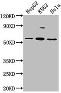 Western Blot
Positive WB detected in: HepG2 whole cell lysate, K562 whole cell lysate, Hela whole cell lysate
All lanes: ADRA1A antibody at 1:2000
Secondary
Goat polyclonal to rabbit IgG at 1/50000 dilution
Predicted band size: 52, 53, 48, 51, 33, 38, 36, 41 kDa
Observed band size: 52 kDa