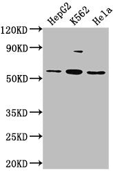 Western Blot
Positive WB detected in: HepG2 whole cell lysate, K562 whole cell lysate, Hela whole cell lysate
All lanes: ADRA1A antibody at 1:2000
Secondary
Goat polyclonal to rabbit IgG at 1/50000 dilution
Predicted band size: 52, 53, 48, 51, 33, 38, 36, 41 kDa
Observed band size: 52 kDa