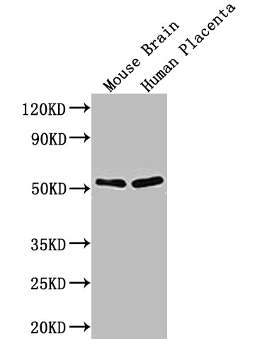 Western Blot
Positive WB detected in:Mouse Brain tissue lysate,Human Placenta tissue lysate
All lanes: ADRB1 antibody at 1:1000
Secondary
Goat polyclonal to rabbit IgG at 1/50000 dilution
Predicted band size: 52 kDa
Observed band size: 52 kDa