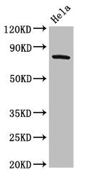 Western Blot
Positive WB detected in: Hela whole cell lysate
All lanes: GRK3 antibody at 2ug/ml
Secondary
Goat polyclonal to rabbit IgG at 1/50000 dilution
Predicted band size: 80 kDa
Observed band size: 80 kDa