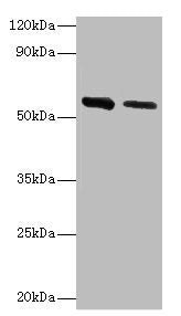 Western blot
All lanes: ADSL antibody at 2µg/ml
Lane 1: Hela whole cell lysate
Lane 2: Mouse heart tissue
Secondary
Goat polyclonal to rabbit IgG at 1/10000 dilution
Predicted band size: 55, 49 kDa
Observed band size: 55 kDa