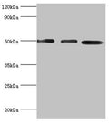 Western blot
All lanes: Adenylosuccinate synthetase isozyme 2 antibody at 12ug/ml
Lane 1: Mouse skeletal muscle tissue
Lane 2: HepG2 whole cell lysate
Lane 3: K562 whole cell lysate
Secondary
Goat polyclonal to rabbit IgG at 1/10000 dilution
Predicted band size: 50 kDa
Observed band size: 50 kDa