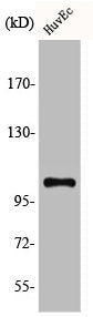 Western Blot analysis of HuvEc cells using CCP2 Polyclonal Antibody
