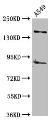 Western Blot
Positive WB detected in: A549 whole cell lysate
All lanes: AFF2 antibody at 5µg/ml
Secondary
Goat polyclonal to rabbit IgG at 1/50000 dilution
Predicted band size: 145, 141, 48, 144, 106 kDa
Observed band size: 145 kDa
