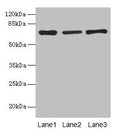 Western blot
All lanes: Afp antibody at 10µg/ml
Lane 1: HepG2 whole cell lysate
Lane 2: Rat liver tissue
Lane 3: 293T whole cell lysate
Secondary
Goat polyclonal to rabbit IgG at 1/10000 dilution
Predicted band size: 68 kDa
Observed band size: 68 kDa