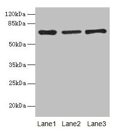 Western blot
All lanes: Afp antibody at 10µg/ml
Lane 1: HepG2 whole cell lysate
Lane 2: Rat liver tissue
Lane 3: 293T whole cell lysate
Secondary
Goat polyclonal to rabbit IgG at 1/10000 dilution
Predicted band size: 68 kDa
Observed band size: 68 kDa