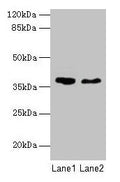 Western blot
All lanes: AGA antibody at 10µg/ml
Lane 1: 293T whole cell lysate
Lane 2: Mouse muscle tissue
Secondary
Goat polyclonal to rabbit IgG at 1/10000 dilution
Predicted band size: 38 kDa
Observed band size: 38 kDa