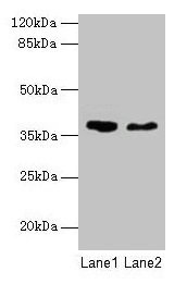 AGA Antibody, HRP conjugated – Figure 1 of 1