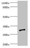 Western blot All lanes: AGPAT2 antibody at 1.09ug/ml + Jurkat whole cell lysate Secondary Goat polyclonal to rabbit IgG at 1/10000 dilution Predicted band size: 31, 28 kDa Observed band size: 31 kDa