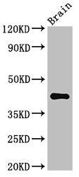 Western Blot
Positive WB detected in: Mouse brain tissue
All lanes: AGPAT5 antibody at 3.4ug/ml
Secondary
Goat polyclonal to rabbit IgG at 1/50000 dilution
Predicted band size: 43 kDa
Observed band size: 43 kDa