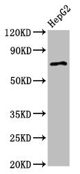 Western Blot
Positive WB detected in: HepG2 whole cell lysate
All lanes: AGPS antibody at 2.7µg/ml
Secondary
Goat polyclonal to rabbit IgG at 1/50000 dilution
Predicted band size: 73 kDa
Observed band size: 73 kDa