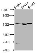 Western Blot
Positive WB detected in: HepG2 whole cell lysate, Rat brain tissue, Rat heart tissue
All lanes: AGT antibody at 4µg/ml
Secondary
Goat polyclonal to rabbit IgG at 1/50000 dilution
Predicted band size: 54 kDa
Observed band size: 54 kDa