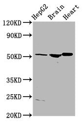 Western Blot
Positive WB detected in: HepG2 whole cell lysate, Rat brain tissue, Rat heart tissue
All lanes: AGT antibody at 4µg/ml
Secondary
Goat polyclonal to rabbit IgG at 1/50000 dilution
Predicted band size: 54 kDa
Observed band size: 54 kDa