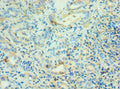 Immunohistochemistry of paraffin-embedded human kidney tissue using CSB-PA001463ESR1HU at dilution of 1:100