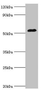Western blot
All lanes: Angiotensinogen antibody at 3ug/ml + Mouse liver tissue
Secondary
Goat polyclonal to rabbit IgG at 1/10000 dilution
Predicted band size: 53 kDa
Observed band size: 53 kDa