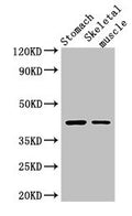 Western Blot
Positive WB detected in: Mouse stomach tissue, Mouse skeletal muscle tissue
All lanes: AGTR1 antibody at 3ug/ml
Secondary
Goat polyclonal to rabbit IgG at 1/50000 dilution
Predicted band size: 42 kDa
Observed band size: 42 kDa