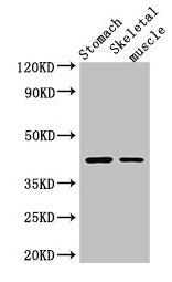 Western Blot
Positive WB detected in: Mouse stomach tissue, Mouse skeletal muscle tissue
All lanes: AGTR1 antibody at 3ug/ml
Secondary
Goat polyclonal to rabbit IgG at 1/50000 dilution
Predicted band size: 42 kDa
Observed band size: 42 kDa