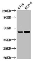Western Blot
Positive WB detected in: A549 whole cell lysate, MCF-7 whole cell lysate
All lanes: AGXT antibody at 3µg/ml
Secondary
Goat polyclonal to rabbit IgG at 1/50000 dilution
Predicted band size: 44 kDa
Observed band size: 44 kDa