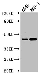 Western Blot
Positive WB detected in: A549 whole cell lysate, MCF-7 whole cell lysate
All lanes: AGXT antibody at 3µg/ml
Secondary
Goat polyclonal to rabbit IgG at 1/50000 dilution
Predicted band size: 44 kDa
Observed band size: 44 kDa