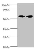 Western blot All lanes: AHCYL1 antibody at 12ug/ml Lane 1: Hela whole cell lysate Lane 2: 293T whole cell lysate Secondary Goat polyclonal to rabbit IgG at 1/10000 dilution Predicted band size: 59, 54 kDa Observed band size: 59 kDa