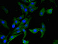 Immunofluorescent analysis of Hela cells using CSB-PA001482LA01HU at dilution of 1:100 and Alexa Fluor 488-congugated AffiniPure Goat Anti-Rabbit IgG(H+L)