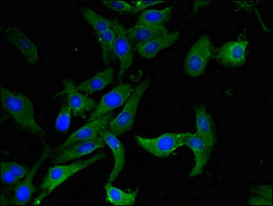 Immunofluorescent analysis of Hela cells using CSB-PA001482LA01HU at dilution of 1:100 and Alexa Fluor 488-congugated AffiniPure Goat Anti-Rabbit IgG(H+L)