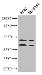 AIM2 Antibody – Figure 1 of 3