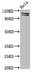 Western Blot
Positive WB detected in: Hela whole cell lysate
All lanes: UBA1 antibody at 2µg/ml
Secondary
Goat polyclonal to rabbit IgG at 1/50000 dilution
Predicted band size: 118, 114 kDa
Observed band size: 118, 114 kDa