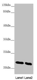 Western blot All lanes: AK1 antibody at 0.51 ug/ml Lane 1: Mouse skeletal muscle tissue Lane 2: Mouse heart tissue Secondary Goat polyclonal to rabbit IgG at 1/10000 dilution Predicted band size: 22 kDa Observed band size: 22 kDa