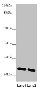 Western blot All lanes: AK1 antibody at 0.51 ug/ml Lane 1: Mouse skeletal muscle tissue Lane 2: Mouse heart tissue Secondary Goat polyclonal to rabbit IgG at 1/10000 dilution Predicted band size: 22 kDa Observed band size: 22 kDa