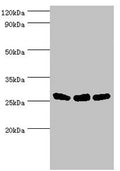 Western blot
All lanes: Adenylate kinase 2, mitochondrial antibody at 5ug/ml
Lane 1: Hela whole cell lysate
Lane 2: Mouse kidney tissue
Lane 3: Mouse small intestine tissue
Secondary
Goat polyclonal to rabbit IgG at 1/10000 dilution
Predicted band size: 27, 26, 23, 15, 25, 22 kDa
Observed band size: 27 kDa