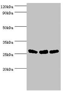 Western blot
All lanes: Adenylate kinase 2, mitochondrial antibody at 5ug/ml
Lane 1: Hela whole cell lysate
Lane 2: Mouse kidney tissue
Lane 3: Mouse small intestine tissue
Secondary
Goat polyclonal to rabbit IgG at 1/10000 dilution
Predicted band size: 27, 26, 23, 15, 25, 22 kDa
Observed band size: 27 kDa