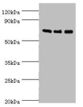 Western blot All lanes: AKAP10 antibody at 7ug/ml Lane 1: 293T whole cell lysate Lane 2: Hela whole cell lysate Lane 3: HepG2 whole cell lysate Secondary Goat polyclonal to rabbit IgG at 1/10000 dilution Predicted band size: 74 kDa Observed band size: 74 kDa