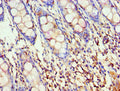 Immunohistochemistry of paraffin-embedded human colon tissue using CSB-PA001527ESR2HU at dilution of 1:100