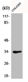 Western Blot analysis of COLO205 cells using Cdk1/Cdc2 Polyclonal Antibody