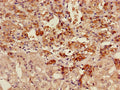 AKAP7 Antibody, Biotin conjugated – Figure 1 of 3